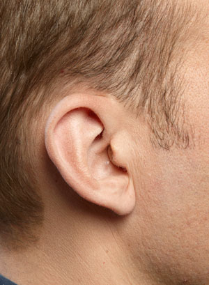 A CIC hearing aid on a man's ear